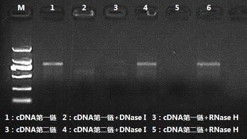 cDNA 第二鏈合成產(chǎn)物酶切驗(yàn)證